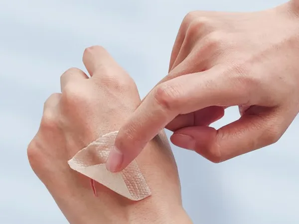 Plastik Luka Gel Silikon